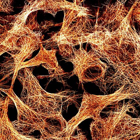 Tubuline dans les cellules COS7 vue par le système SAFe180/Large FOV d'Abbelight. Crédits : Adrien Mau-ISMO/UPSaclay