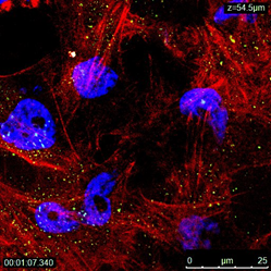 macrophage murene nanomedecine